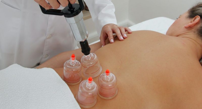 Ventosoterapia2-800×430