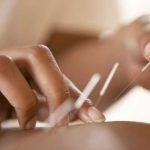 Pós Graduação Lato Sensu em Acupuntura