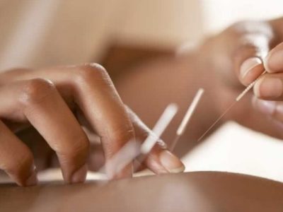Pós Graduação Lato Sensu em Acupuntura