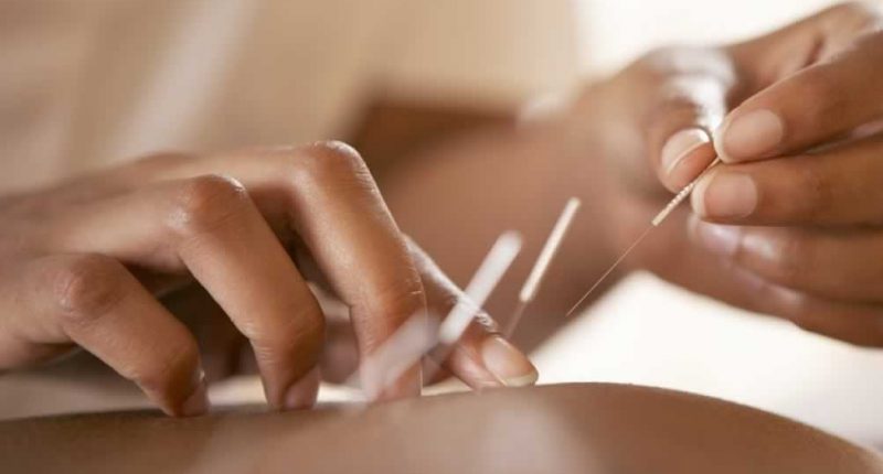acupuntura-legislacao-800×430 acupuntura-legislacao-800×430
